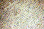 CLCNKA Antibody in Immunohistochemistry (Paraffin) (IHC (P))