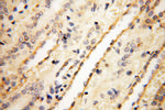 CLCNKA Antibody in Immunohistochemistry (Paraffin) (IHC (P))