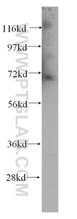 CLCNKA Antibody in Western Blot (WB)