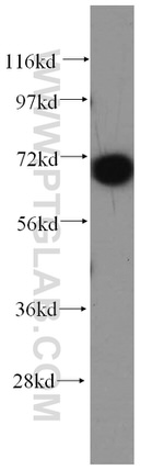 CLCNKA Antibody in Western Blot (WB)