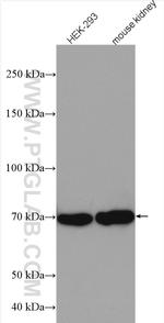 CLCNKA Antibody in Western Blot (WB)