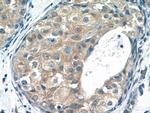 TRAF3IP1 Antibody in Immunohistochemistry (Paraffin) (IHC (P))