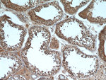 HE4 Antibody in Immunohistochemistry (Paraffin) (IHC (P))