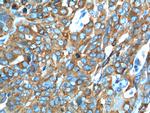 HE4 Antibody in Immunohistochemistry (Paraffin) (IHC (P))