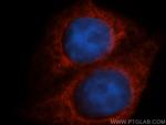 TAB2 Antibody in Immunocytochemistry (ICC/IF)