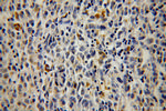 TAB2 Antibody in Immunohistochemistry (Paraffin) (IHC (P))