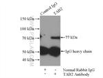 TAB2 Antibody in Immunoprecipitation (IP)