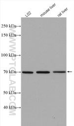 TAB2 Antibody in Western Blot (WB)