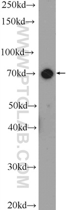 TAB2 Antibody in Western Blot (WB)