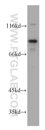 PIBF1 Antibody in Western Blot (WB)