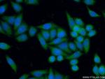 GALE Antibody in Immunocytochemistry (ICC/IF)