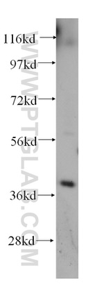 GALE Antibody in Western Blot (WB)