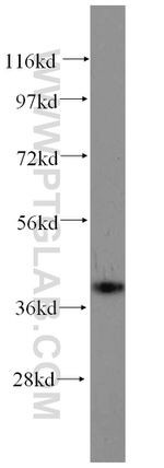 GALE Antibody in Western Blot (WB)