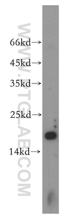 UBE2L3 Antibody in Western Blot (WB)