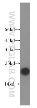 UBE2L3 Antibody in Western Blot (WB)