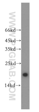 UBE2L3 Antibody in Western Blot (WB)