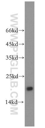 UBE2L3 Antibody in Western Blot (WB)