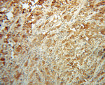 NDUFS6 Antibody in Immunohistochemistry (Paraffin) (IHC (P))