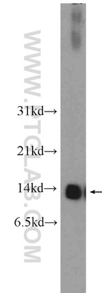 NDUFS6 Antibody in Western Blot (WB)