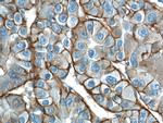 ATP1A1 Antibody in Immunohistochemistry (Paraffin) (IHC (P))