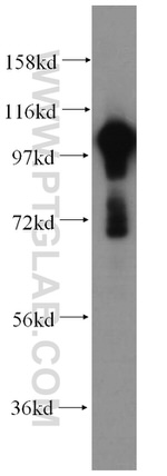 ATP1A1 Antibody in Western Blot (WB)