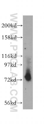 TCF12/HEB Antibody in Western Blot (WB)