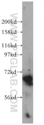 CHSY1 Antibody in Western Blot (WB)