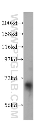 CHSY1 Antibody in Western Blot (WB)