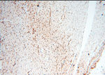 TIMELESS Antibody in Immunohistochemistry (Paraffin) (IHC (P))