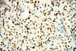 TIMELESS Antibody in Immunohistochemistry (Paraffin) (IHC (P))