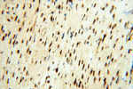 TIMELESS Antibody in Immunohistochemistry (Paraffin) (IHC (P))