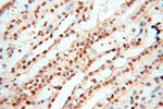 TIMELESS Antibody in Immunohistochemistry (Paraffin) (IHC (P))