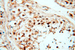 TIMELESS Antibody in Immunohistochemistry (Paraffin) (IHC (P))