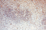 TIMELESS Antibody in Immunohistochemistry (Paraffin) (IHC (P))