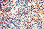 TIMELESS Antibody in Immunohistochemistry (Paraffin) (IHC (P))