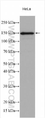 TIMELESS Antibody in Western Blot (WB)