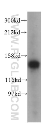 TIMELESS Antibody in Western Blot (WB)