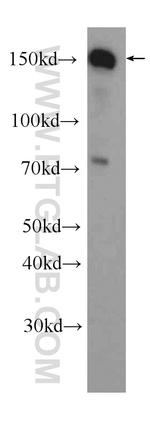 TIMELESS Antibody in Western Blot (WB)