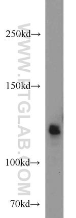 RBM10 Antibody in Western Blot (WB)