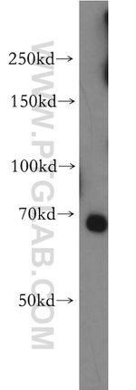 TAX1BP1 Antibody in Western Blot (WB)