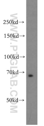 TAX1BP1 Antibody in Western Blot (WB)