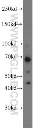 TAX1BP1 Antibody in Western Blot (WB)