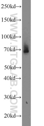 TAX1BP1 Antibody in Western Blot (WB)