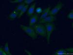 Apolipoprotein AI Antibody in Immunocytochemistry (ICC/IF)