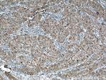 Apolipoprotein AI Antibody in Immunohistochemistry (Paraffin) (IHC (P))