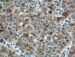 Apolipoprotein AI Antibody in Immunohistochemistry (Paraffin) (IHC (P))