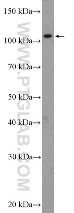 SETDB2 Antibody in Western Blot (WB)