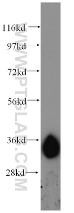 AMPK beta 2 Antibody in Western Blot (WB)