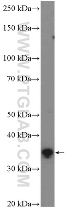 AMPK beta 2 Antibody in Western Blot (WB)