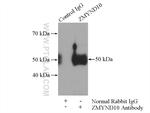 ZMYND10 Antibody in Immunoprecipitation (IP)